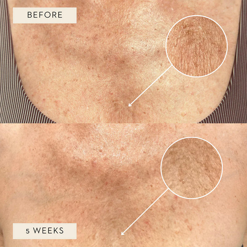 Mukti Age Defiance Body Serum results